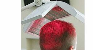 laser hair loss treatment therapy raleigh